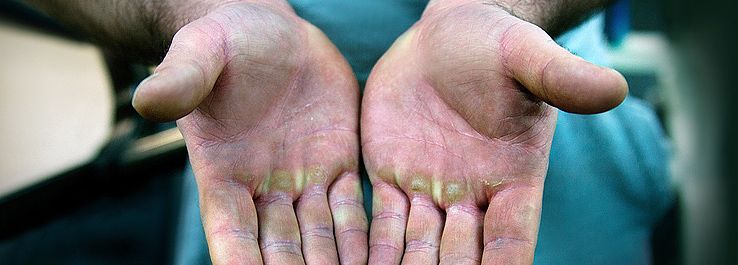 /uploads/posts/Mãos calejadas | Histórias para reflexão